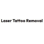 Laser Tattoo Removal Treatment : LaserAway