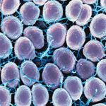 Harmful Bacteria And Parasites - Vivolabs