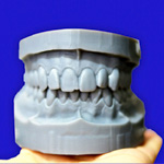 Identity Teeth Models | DentistiHomeDental