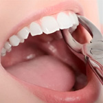 Temp Teeth : Dentist.ihomedental.com 